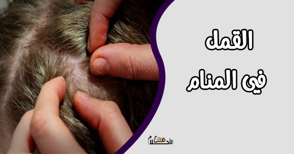 تفسير حلم القمل