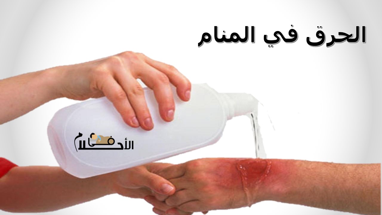الحرق في المنام