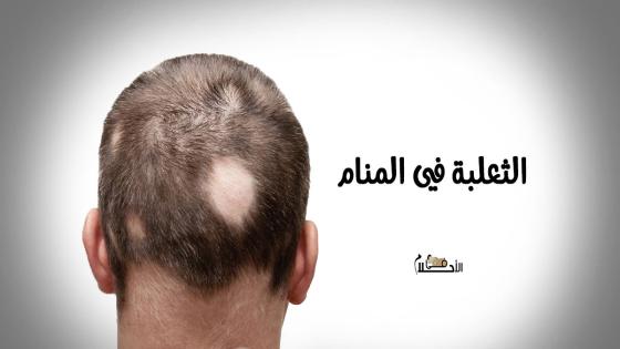 الثعلبة في المنام