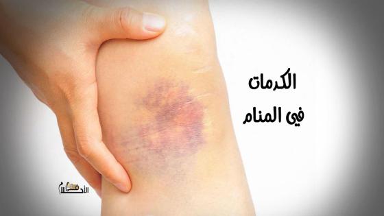 الكدمات في المنام