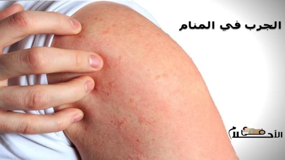 الجرب في المنام
