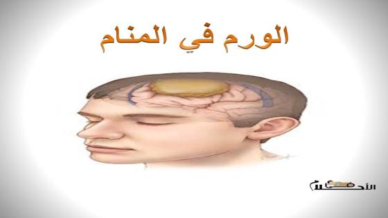 الورم في المنام