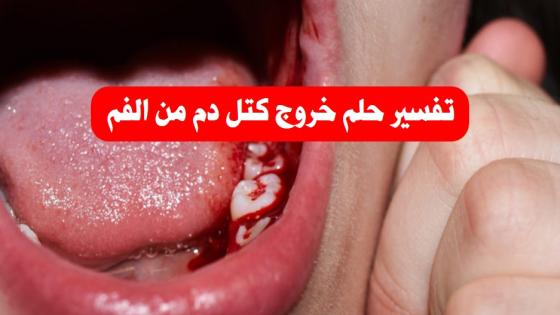 تفسير حلم خروج كتل دم من الفم